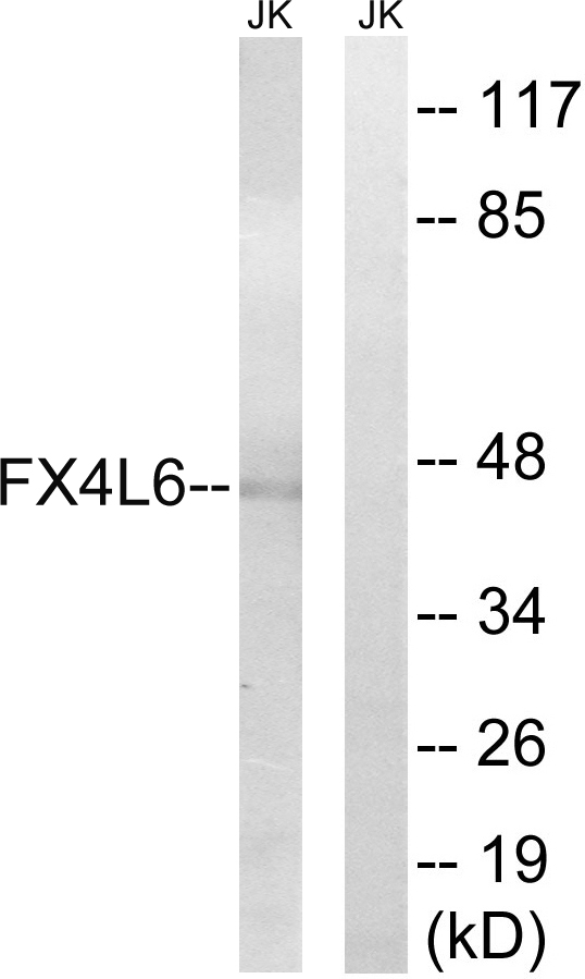 FOXD4 + FOXD4L Antibody - Western blot analysis of lysates from Jurkat cells, using FOXD4/L2/L3/L4/L5/L6 Antibody. The lane on the right is blocked with the synthesized peptide.