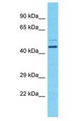 FOXD4L1 / FOXD5 Antibody - FOXD4L1 / FOXD5 antibody Western Blot of Fetal Brain. Antibody dilution: 1 ug/ml.  This image was taken for the unconjugated form of this product. Other forms have not been tested.