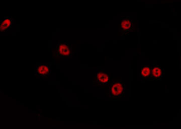 FOXD4L1 / FOXD5 Antibody - Staining HepG2 cells by IF/ICC. The samples were fixed with PFA and permeabilized in 0.1% Triton X-100, then blocked in 10% serum for 45 min at 25°C. The primary antibody was diluted at 1:200 and incubated with the sample for 1 hour at 37°C. An Alexa Fluor 594 conjugated goat anti-rabbit IgG (H+L) Ab, diluted at 1/600, was used as the secondary antibody.