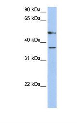 FOXD4L3 Antibody - Hela cell lysate. Antibody concentration: 1.0 ug/ml. Gel concentration: 12%.  This image was taken for the unconjugated form of this product. Other forms have not been tested.