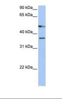 FOXD4L3 Antibody - Hela cell lysate. Antibody concentration: 1.0 ug/ml. Gel concentration: 12%.  This image was taken for the unconjugated form of this product. Other forms have not been tested.