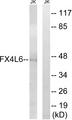 FOXD4L6 Antibody - Western blot analysis of extracts from Jurkat cells, using FOXD4D4/L2/L3/L4/L5/L6 antibody.