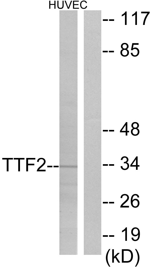FOXE2 / FOXE1 Antibody - Western blot analysis of lysates from HUVEC cells, using TTF2 Antibody. The lane on the right is blocked with the synthesized peptide.