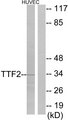 FOXE2 / FOXE1 Antibody - Western blot analysis of lysates from HUVEC cells, using TTF2 Antibody. The lane on the right is blocked with the synthesized peptide.