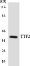FOXE2 / FOXE1 Antibody - Western blot analysis of the lysates from HUVECcells using TTF2 antibody.
