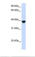 FOXE2 / FOXE1 Antibody - Fetal muscle lysate. Antibody concentration: 1.0 ug/ml. Gel concentration: 12%.  This image was taken for the unconjugated form of this product. Other forms have not been tested.