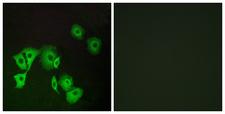 FOXE2 / FOXE1 Antibody - Immunofluorescence analysis of A549 cells, using TTF2 Antibody. The picture on the right is blocked with the synthesized peptide.