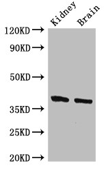 FOXE2 / FOXE1 Antibody - Positive WB detected in:Mouse kidney tissue,Mouse brain tissue;All lanes:FOXE1 antibody at 2.4?g/ml;Secondary;Goat polyclonal to rabbit IgG at 1/50000 dilution;Predicted band size: 39 KDa;Observed band size: 39 KDa;