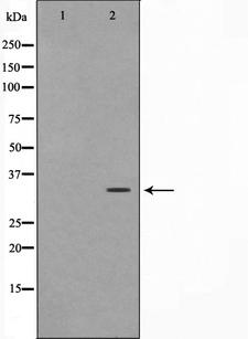 FOXE2 / FOXE1 Antibody - Western blot analysis on HuvEc cell lysates using TTF2 antibody. The lane on the left is treated with the antigen-specific peptide.