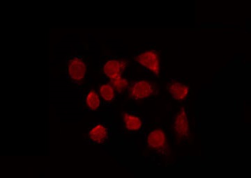 FOXE2 / FOXE1 Antibody - Staining HuvEc cells by IF/ICC. The samples were fixed with PFA and permeabilized in 0.1% Triton X-100, then blocked in 10% serum for 45 min at 25°C. The primary antibody was diluted at 1:200 and incubated with the sample for 1 hour at 37°C. An Alexa Fluor 594 conjugated goat anti-rabbit IgG (H+L) Ab, diluted at 1/600, was used as the secondary antibody.