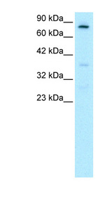 FOXE3 Antibody - FOXE3 antibody Western blot of HepG2 cell lysate. This image was taken for the unconjugated form of this product. Other forms have not been tested.