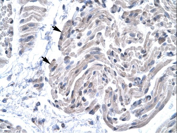 FOXE3 Antibody - Human Muscle.  This image was taken for the unconjugated form of this product. Other forms have not been tested.
