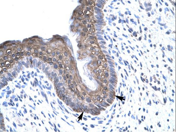 FOXE3 Antibody - Human Spermatophore.  This image was taken for the unconjugated form of this product. Other forms have not been tested.