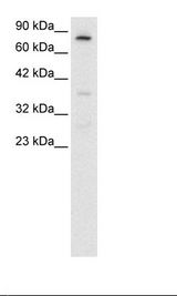 FOXE3 Antibody - HepG2 Cell Lysate.  This image was taken for the unconjugated form of this product. Other forms have not been tested.