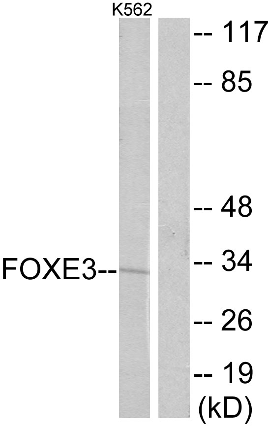 FOXE3 Antibody - Western blot analysis of lysates from K562 cells, using FOXE3 Antibody. The lane on the right is blocked with the synthesized peptide.