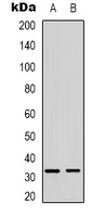FOXE3 Antibody - Western blot analysis of FOXE3 expression in SHSYSY (A); MDAMB435 (B) whole cell lysates.