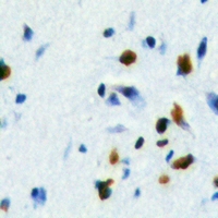 FOXE3 Antibody - Immunohistochemical analysis of FOXE3 staining in human brain formalin fixed paraffin embedded tissue section. The section was pre-treated using heat mediated antigen retrieval with sodium citrate buffer (pH 6.0). The section was then incubated with the antibody at room temperature and detected with HRP and DAB as chromogen. The section was then counterstained with hematoxylin and mounted with DPX.