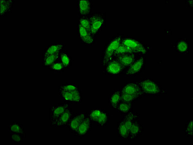 FOXE3 Antibody - Immunofluorescence staining of HepG2 cells at a dilution of 1:166, counter-stained with DAPI. The cells were fixed in 4% formaldehyde, permeabilized using 0.2% Triton X-100 and blocked in 10% normal Goat Serum. The cells were then incubated with the antibody overnight at 4 °C.The secondary antibody was Alexa Fluor 488-congugated AffiniPure Goat Anti-Rabbit IgG (H+L) .