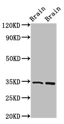 FOXE3 Antibody - Positive Western Blot detected in Mouse brain tissue, Rat brain tissue. All lanes: FOXE3 antibody at 4 µg/ml Secondary Goat polyclonal to rabbit IgG at 1/50000 dilution. Predicted band size: 34 KDa. Observed band size: 34 KDa