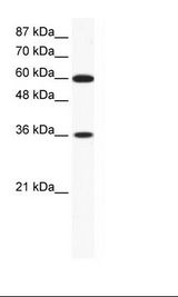 FOXF1 Antibody - Jurkat Cell Lysate.  This image was taken for the unconjugated form of this product. Other forms have not been tested.
