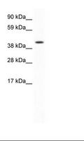 FOXF1 Antibody - SP2/0 Cell Lysate.  This image was taken for the unconjugated form of this product. Other forms have not been tested.