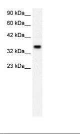 FOXF1 Antibody - Placenta Lysate.  This image was taken for the unconjugated form of this product. Other forms have not been tested.