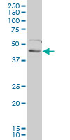 FOXF2 Antibody - FOXF2 monoclonal antibody (M01), clone 2D7. Western Blot analysis of FOXF2 expression in H9c2(2-1).
