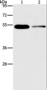 FOXF2 Antibody - Western blot analysis of Human placenta and human normal liver tissue, using FOXF2 Polyclonal Antibody at dilution of 1:666.