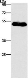 FOXF2 Antibody - Western blot analysis of Human placenta tissue, using FOXF2 Polyclonal Antibody at dilution of 1:733.