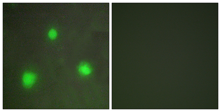 FOXH1 Antibody - Immunofluorescence analysis of A549 cells, using FOXH1 Antibody. The picture on the right is blocked with the synthesized peptide.