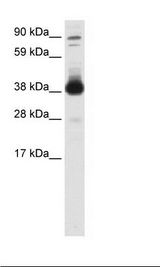 FOXH1 Antibody - SP2/0 Cell Lysate.  This image was taken for the unconjugated form of this product. Other forms have not been tested.