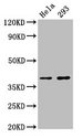 FOXH1 Antibody - Positive Western Blot detected in Hela whole cell lysate, 293 whole cell lysate. All lanes: FOXH1 antibody at 2.7 µg/ml Secondary Goat polyclonal to rabbit IgG at 1/50000 dilution. Predicted band size: 40 KDa. Observed band size: 40 KDa