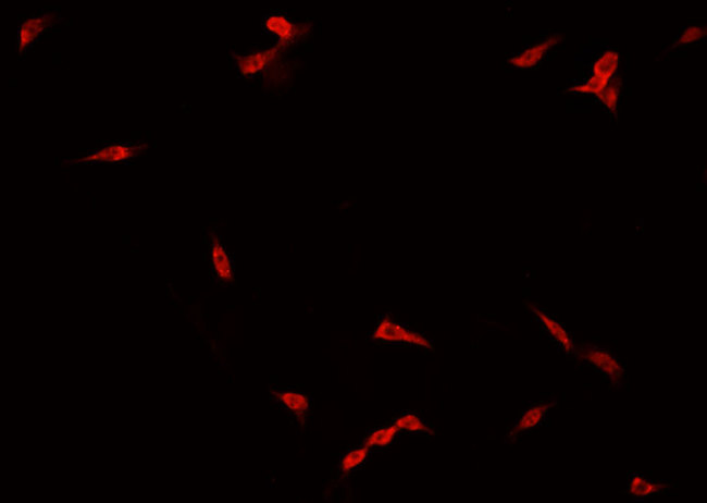 FOXH1 Antibody - Staining NCI-H929 cells by IF/ICC. The samples were fixed with PFA and permeabilized in 0.1% Triton X-100, then blocked in 10% serum for 45 min at 25°C. The primary antibody was diluted at 1:200 and incubated with the sample for 1 hour at 37°C. An Alexa Fluor 594 conjugated goat anti-rabbit IgG (H+L) antibody, diluted at 1/600, was used as secondary antibody.