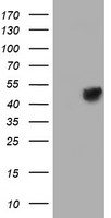 FOXI1 Antibody - HEK293T cells were transfected with the pCMV6-ENTRY control (Left lane) or pCMV6-ENTRY FOXI1 (Right lane) cDNA for 48 hrs and lysed. Equivalent amounts of cell lysates (5 ug per lane) were separated by SDS-PAGE and immunoblotted with anti-FOXI1.