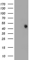 FOXI1 Antibody - HEK293T cells were transfected with the pCMV6-ENTRY control (Left lane) or pCMV6-ENTRY FOXI1 (Right lane) cDNA for 48 hrs and lysed. Equivalent amounts of cell lysates (5 ug per lane) were separated by SDS-PAGE and immunoblotted with anti-FOXI1.