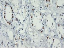 FOXI1 Antibody - IHC of paraffin-embedded Human Kidney tissue using anti-FOXI1 mouse monoclonal antibody.