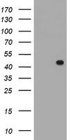 FOXI1 Antibody - HEK293T cells were transfected with the pCMV6-ENTRY control (Left lane) or pCMV6-ENTRY FOXI1 (Right lane) cDNA for 48 hrs and lysed. Equivalent amounts of cell lysates (5 ug per lane) were separated by SDS-PAGE and immunoblotted with anti-FOXI1.