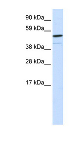 FOXI1 Antibody - FOXI1 antibody Western blot of Fetal kidney lysate. This image was taken for the unconjugated form of this product. Other forms have not been tested.