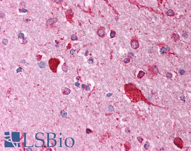FOXI1 Antibody - Anti-FOXI1 antibody IHC of human brain, cortex. Immunohistochemistry of formalin-fixed, paraffin-embedded tissue after heat-induced antigen retrieval. Antibody concentration 5 ug/ml.  This image was taken for the unconjugated form of this product. Other forms have not been tested.