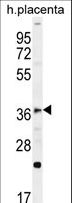 FOXI1 Antibody - FOXI1 Antibody western blot of human placenta tissue lysates (35 ug/lane). The FOXI1 antibody detected the FOXI1 protein (arrow).