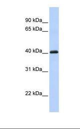 FOXI1 Antibody - Fetal heart lysate. Antibody concentration: 1.0 ug/ml. Gel concentration: 12%.  This image was taken for the unconjugated form of this product. Other forms have not been tested.