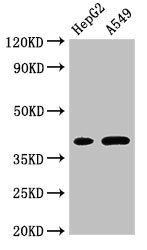 FOXI1 Antibody - Western Blot Positive WB detected in:HepG2 whole cell lysate,A549 whole cell lysate All Lanes:FOXI1 antibody at 3µg/ml Secondary Goat polyclonal to rabbit IgG at 1/50000 dilution Predicted band size: 41,31 KDa Observed band size: 41 KDa