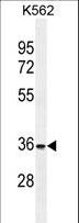 FOXI3 Antibody - FOXI3 Antibody western blot of K562 cell line lysates (35 ug/lane). The FOXI3 antibody detected the FOXI3 protein (arrow).