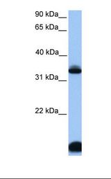 FOXI3 Antibody - HepG2 cell lysate. Antibody concentration: 1.0 ug/ml. Gel concentration: 12%.  This image was taken for the unconjugated form of this product. Other forms have not been tested.