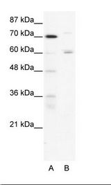 FOXJ2 Antibody - A: Marker, B: HepG2 Cell Lysate.  This image was taken for the unconjugated form of this product. Other forms have not been tested.