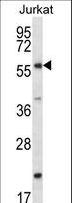 FOXJ3 Antibody - FOXJ3 Antibody western blot of Jurkat cell line lysates (35 ug/lane). The FOXJ3 antibody detected the FOXJ3 protein (arrow).