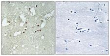 FOXJ3 Antibody - Immunohistochemistry analysis of paraffin-embedded human brain tissue, using FOXJ3 Antibody. The picture on the right is blocked with the synthesized peptide.