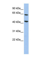 FOXJ3 Antibody - FOXJ3 antibody Western blot of HepG2 cell lysate. This image was taken for the unconjugated form of this product. Other forms have not been tested.