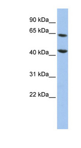 FOXJ3 Antibody - FOXJ3 antibody Western blot of HepG2 cell lysate. This image was taken for the unconjugated form of this product. Other forms have not been tested.