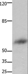 FOXJ3 Antibody - Western blot analysis of Human liver cancer tissue, using FOXJ3 Polyclonal Antibody at dilution of 1:800.